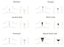 Graphique montrant différentes formes de poils pubiens