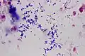 Cocci Gram + non identifiés dans un échantillon de pus