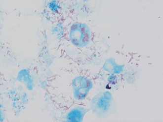 Description de l'image Rickettsia conorii in Vero.gif.