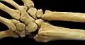 Extrémités distales du radius et de l'ulna avec les os du poignet et de la main.