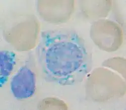 sideroblast
