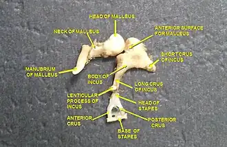 Dissection des osselets de l'oreille moyenne
