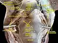 Larynx, pharynx et langue.dissection profonde, vue postérieure.