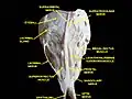 Vue supérieure d'une dissection de l'orbite. Le nerf frontal est visible en se ramifiant dans les nerfs supratrochléaire et supraorbitaire.