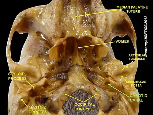 Canal carotidien.