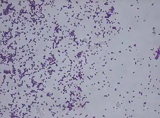Description de l'image Staphylococcus saprophyticus.jpg.