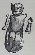 Croquis de Thomas Bartholin (1654).