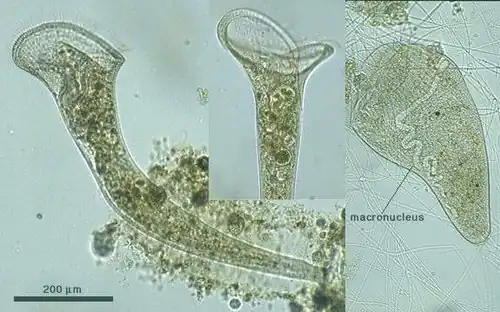 Cilié : stentor roeseli.