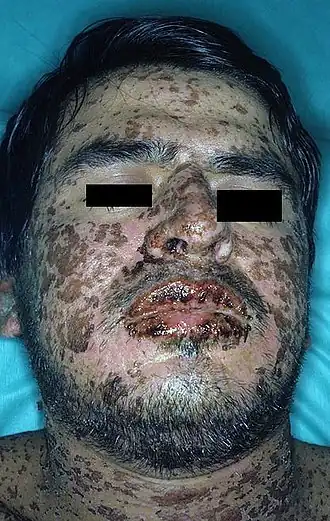 Description de cette image, également commentée ci-après