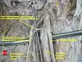 Ganglion cervical supérieur