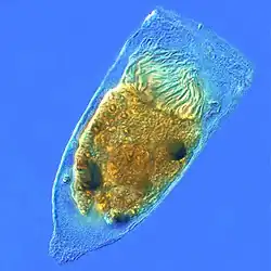Favella sp. (Ptychocylididae).
