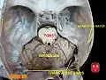 Les sinus transverses.
