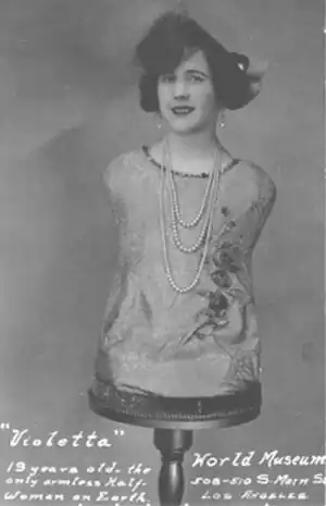 Violetta, «&nbsp;femme-tronc&nbsp;» (1906/1907-Inconnu).