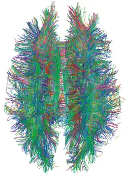 Ensemble de ligne colorées dessinant la silhouette de deux hémisphères cérébraux humains.