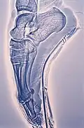 Xérographie du pied d'une danseuse dans son chausson faisant des pointes.