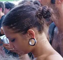 Jeune fille portant un écarteur.