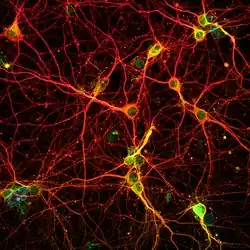 Des petites cellules vertes liées entre elles par un réseau inextricable de ramifications rouges.